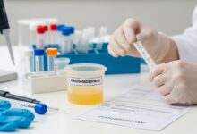 Alkoholabstinenz mit Urintest